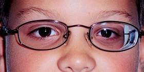 Anisometropia